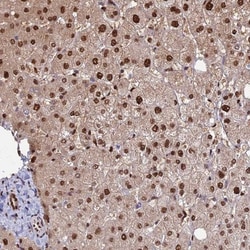 Aspartyl Aminopeptidase Antibody, Novus Biologicals:Antibodies:Primary
