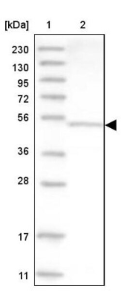 Aspartyl Aminopeptidase Antibody, Novus Biologicals:Antibodies:Primary