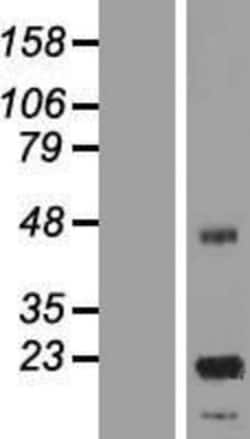 Novus Biologicals&trade;&nbsp;ASPDH Overexpression Lysate