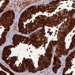 ASPDH Antibody, Novus Biologicals 25 &mu;L; Unlabeled:Antibodies, Polyclonal