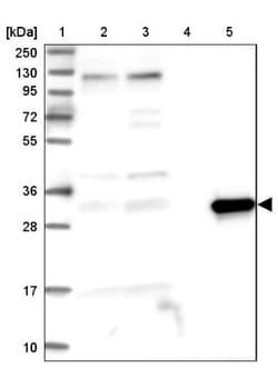 ASPDH Antibody, Novus Biologicals 25 &mu;L; Unlabeled:Antibodies, Polyclonal