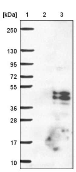 ASPHD1 Antibody, Novus Biologicals 0.1mL; Unlabeled:Antibodies, Polyclonal