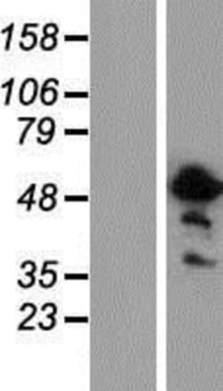 Novus Biologicals&trade;&nbsp;ASPHD2 Overexpression Lysate
