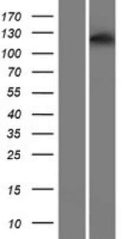 Novus Biologicals&trade;&nbsp;ASPP1 Overexpression Lysate