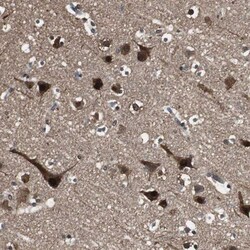 ASPP1 Antibody, Novus Biologicals:Antibodies:Primary Antibodies