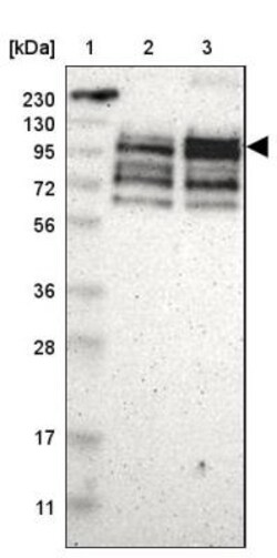 ASPP1 Antibody, Novus Biologicals:Antibodies:Primary Antibodies