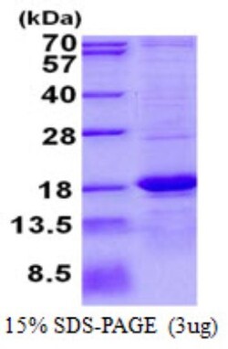 Novus Biologicals&trade;&nbsp;Recombinant Human ASPRV1 His Protein