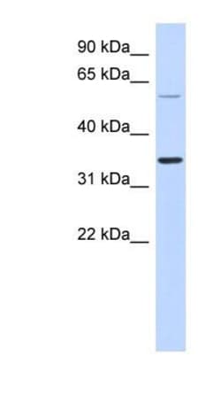 ASPRV1 Antibody, Novus Biologicals 100&mu;L; Unlabeled:Antibodies, Polyclonal