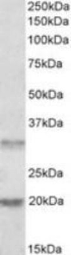 ASRGL1 Antibody, Novus Biologicals 0.1mg; Unlabeled:Antibodies, Polyclonal