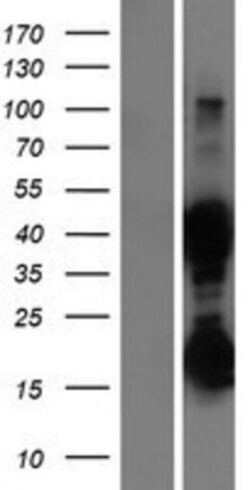 Novus Biologicals&trade;&nbsp;ASRGL1 Overexpression Lysate