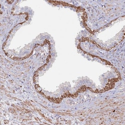 ASTE1 Antibody, Novus Biologicals 25 &mu;L; Unlabeled:Antibodies, Polyclonal
