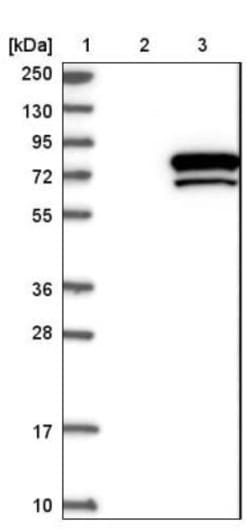 ASTE1 Antibody, Novus Biologicals 0.1 mL | Buy Online | Novus Biologicals | Fisher Scientific