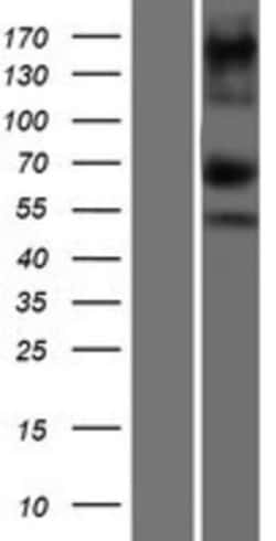 Novus Biologicals™ ASXL1 Overexpression Lysate