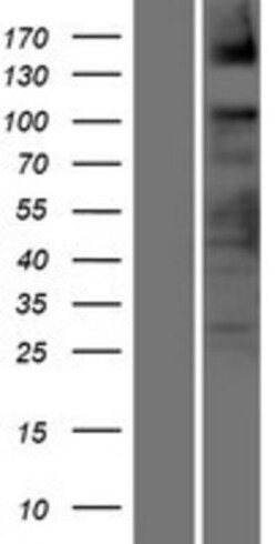 Novus Biologicals&trade;&nbsp;ASXL2 Overexpression Lysate