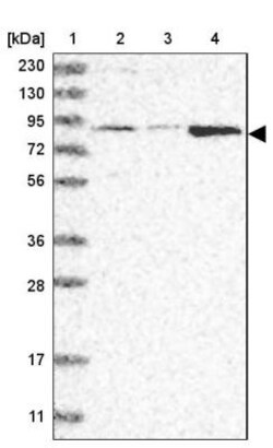 ATAD2B Antibody, Novus Biologicals 25 &mu;L | Buy Online | Novus Biologicals | Fisher Scientific