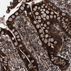 ATAD4 Antibody, Novus Biologicals:Antibodies:Primary Antibodies