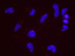 Atad5 Antibody, Novus Biologicals 0.1mg; Unlabeled:Antibodies, Polyclonal