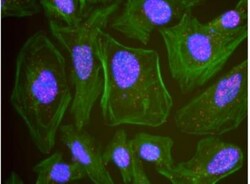 Atad5 Antibody, Novus Biologicals 0.1mg; Unlabeled:Antibodies, Polyclonal