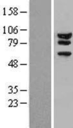 Novus Biologicals™ Ataxin 1 Overexpression Lysate