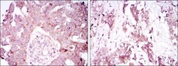anti-Ataxin 1, Clone: 2F5, Novus Biologicals 0.1mL; Unlabeled, Quantity: