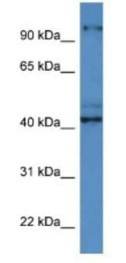 ATCAY Antibody, Novus Biologicals:Antibodies:Primary Antibodies