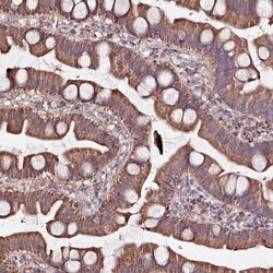 ATE1 Antibody, Novus Biologicals 0.1mL; Unlabeled:Antibodies, Polyclonal