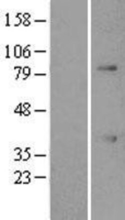 Novus Biologicals&trade;&nbsp;ATF1 Overexpression Lysate