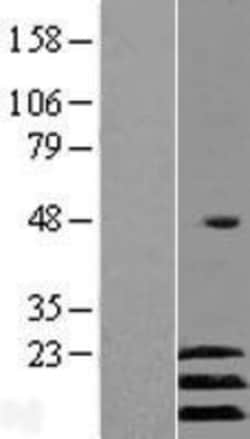 Novus Biologicals&trade;&nbsp;ATF3 Overexpression Lysate