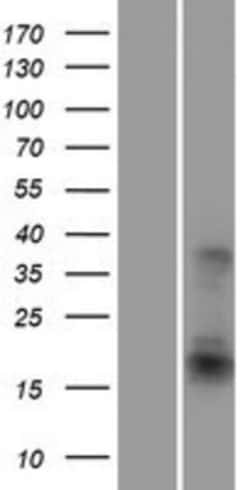 Novus Biologicals&trade;&nbsp;ATF3 Overexpression Lysate