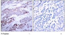 ATF4, p Ser245 Antibody, Novus Biologicals:Antibodies:Primary Antibodies