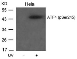ATF4, p Ser245 Antibody, Novus Biologicals:Antibodies:Primary Antibodies
