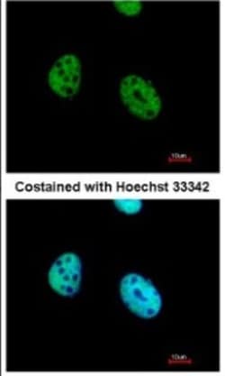 ATF7 Antibody, Novus Biologicals 0.1mL; Unlabeled:Antibodies, Polyclonal