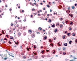 ATF7 Antibody, Novus Biologicals 0.1mg; Unlabeled:Antibodies, Polyclonal