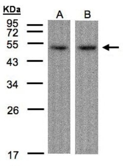 ATF7 Antibody, Novus Biologicals 0.1mL; Unlabeled:Antibodies, Polyclonal