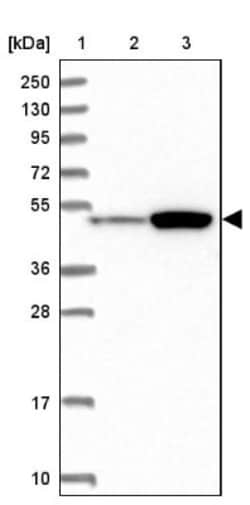 ATF7IP2 Antibody, Novus Biologicals 25 &mu;L, Unlabeled:Antibodies, Polyclonal
