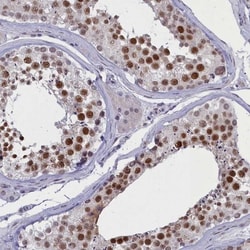ATF7IP2 Antibody, Novus Biologicals 25 &mu;L, Unlabeled:Antibodies, Polyclonal