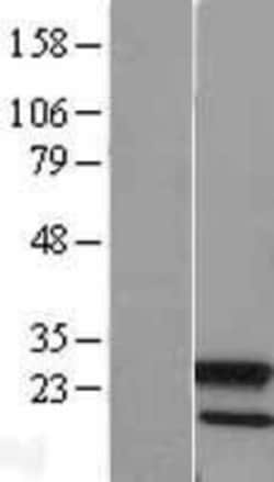 Novus Biologicals&trade;&nbsp;ATG12 Overexpression Lysate