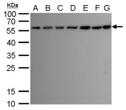 ATG12 Antibody (948), Novus Biologicals 0.1mL; Unlabeled:Antibodies, Monoclonal