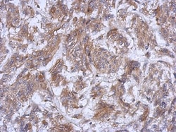 ATG16L1 Antibody, Novus Biologicals 0.1mL; Unlabeled:Antibodies, Polyclonal