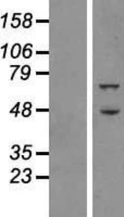 Novus Biologicals™ ATG16L1 Overexpression Lysate