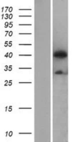 Novus Biologicals&trade;&nbsp;ATG4B Overexpression Lysate
