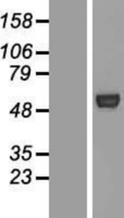 Novus Biologicals&trade;&nbsp;ATG4C Overexpression Lysate