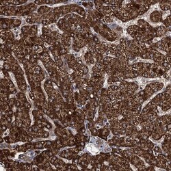 ATHL1 Antibody, Novus Biologicals:Antibodies:Primary Antibodies