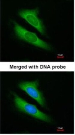 ATIC Antibody, Novus Biologicals 0.1mL; Unlabeled:Antibodies, Polyclonal