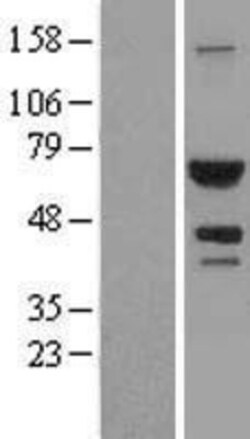 Novus Biologicals™ ATIC Overexpression Lysate