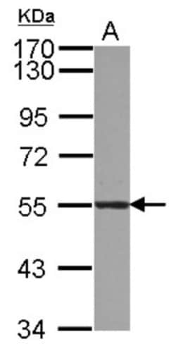 Atlastin-3 Antibody, Novus Biologicals 0.1mL; Unlabeled:Antibodies, Polyclonal