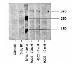 ATM, p Ser1981 Antibody (10H11.E12), Novus Biologicals 0.1mL; Unlabeled:Antibodies,
