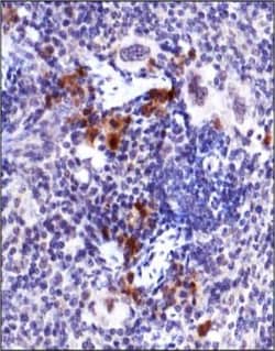 ATM, p Ser1981 Antibody (10H11.E12), Novus Biologicals 0.1mL; Unlabeled:Antibodies,