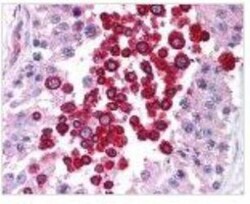 ATM Antibody (2C1), Novus Biologicals 0.1mg; Unlabeled:Antibodies, Monoclonal