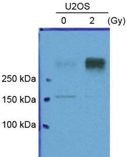 ATM Antibody (2C1), Novus Biologicals 0.1mg; Unlabeled:Antibodies, Monoclonal